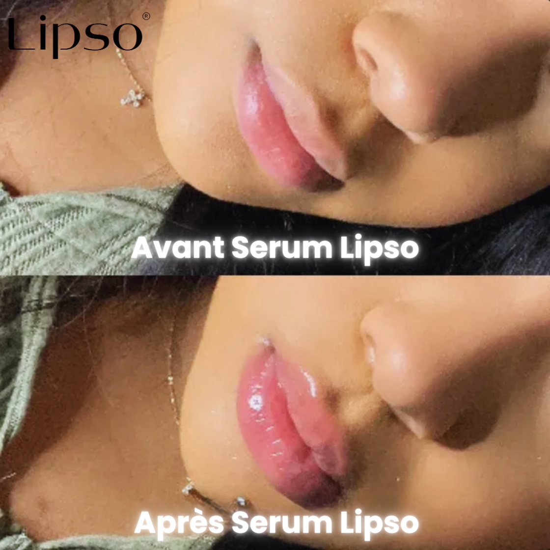 Serum volumateur Lipso